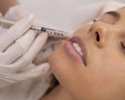 Lip Fillers & Lip Injections 